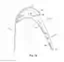 Fig. 17 - CONFIGURATIONS FOR TURBINE ROTOR BLADE TIPS