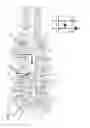 Fig. 11 - Multi-mode variable cam timing phaser