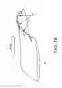 Fig. 10 - System and method for a fluidic barrier from the upstream splitter