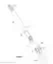 Fig. 03 - Expansion Anchor