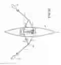 Fig. 05 - Reversing gear drive