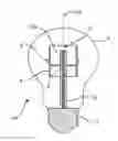 Fig. 01 - Lighting device with a wireless communication antenna