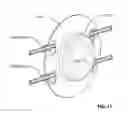 Fig. 13 - Stimulant target unit and accessory for a stimulant target unit