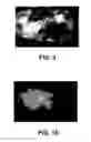 Fig. 10 - Fluorescence biopsy specimen imager and methods