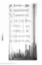 Fig. 03 - NOVEL METHODS AND KITS FOR DETECTING OF UREA CYCLE DISORDERS USING MASS SPECTROMETRY
