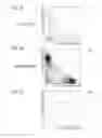 Fig. 08 - Urine sample analyzer and urine sample analyzing method
