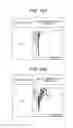Fig. 16 - Blood analyzing method as well as stain solution and blood analyzer used for the same