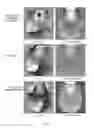 Fig. 20 - MRI with reconstruction of MR phase image