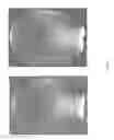 Fig. 24 - MRI with reconstruction of MR phase image