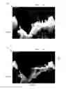 Fig. 16 - Multichannel sonar systems and methods