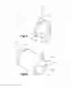 Fig. 07 - Feedthrough assembly and method of assembling a feedthrough assembly
