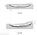 Fig. 03 - Apical conduit and methods of using same