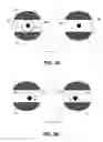 Fig. 04 - Apparatus, system and method for photodetection with a transimpedance amplifier of an eye-mountable device