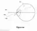Fig. 12 - Devices and methods for removing zeroth order leakage in beam steering devices