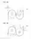 Fig. 03 - Fixing device with recording medium temperature control