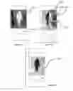 Fig. 05 - Processing an infrared (IR) image based on swipe gestures