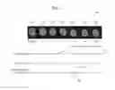 Fig. 08 - Apparatus and method of processing magnetic resonance (MR) images