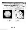Fig. 11 - METHOD FOR ANALYZING BIOLOGICAL SPECIMENS BY SPECTRAL IMAGING