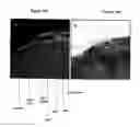 Fig. 19 - METHOD FOR ANALYZING BIOLOGICAL SPECIMENS BY SPECTRAL IMAGING