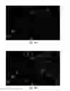 Fig. 05 - Positional error correction in a tomographic imaging apparatus