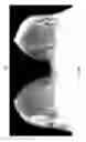 Fig. 07 - Contrast medium uptake time computation using magnetic resonance imaging