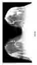 Fig. 08 - Contrast medium uptake time computation using magnetic resonance imaging