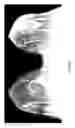 Fig. 09 - Contrast medium uptake time computation using magnetic resonance imaging