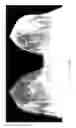 Fig. 10 - Contrast medium uptake time computation using magnetic resonance imaging
