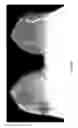Fig. 11 - Contrast medium uptake time computation using magnetic resonance imaging