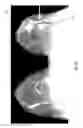 Fig. 12 - Contrast medium uptake time computation using magnetic resonance imaging