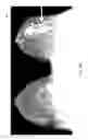 Fig. 13 - Contrast medium uptake time computation using magnetic resonance imaging