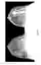 Fig. 14 - Contrast medium uptake time computation using magnetic resonance imaging
