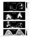 Fig. 15 - Contrast medium uptake time computation using magnetic resonance imaging
