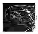 Fig. 18 - Contrast medium uptake time computation using magnetic resonance imaging