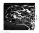 Fig. 19 - Contrast medium uptake time computation using magnetic resonance imaging