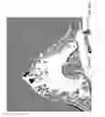 Fig. 24 - Contrast medium uptake time computation using magnetic resonance imaging