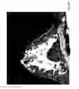 Fig. 25 - Contrast medium uptake time computation using magnetic resonance imaging