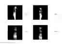 Fig. 01 - IMAGE IDENTIFICATION METHOD, MAGNETIC RESONANCE IMAGING METHOD AND IMAGING APPARATUS