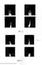 Fig. 03 - IMAGE IDENTIFICATION METHOD, MAGNETIC RESONANCE IMAGING METHOD AND IMAGING APPARATUS