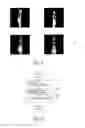 Fig. 04 - IMAGE IDENTIFICATION METHOD, MAGNETIC RESONANCE IMAGING METHOD AND IMAGING APPARATUS