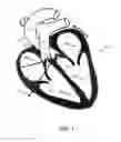 Fig. 02 - Method for the quantification of the presence of fats in a region of the heart