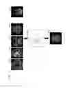 Fig. 03 - Method and apparatus for processing magnetic resonance image