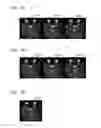 Fig. 13 - Method and apparatus for processing magnetic resonance image