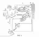 Fig. 02 - Systems and methods for determining orientation of an implanted lead
