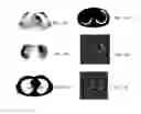 Fig. 14 - System and method for image calibration