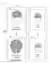 Fig. 01 - System for processing magnetic resonance images using automatic segmenting