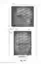 Fig. 06 - System for processing magnetic resonance images using automatic segmenting