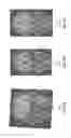 Fig. 16 - System for processing magnetic resonance images using automatic segmenting
