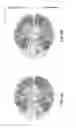 Fig. 17 - System for processing magnetic resonance images using automatic segmenting