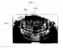 Fig. 10 - Method and apparatus for providing panorama image data